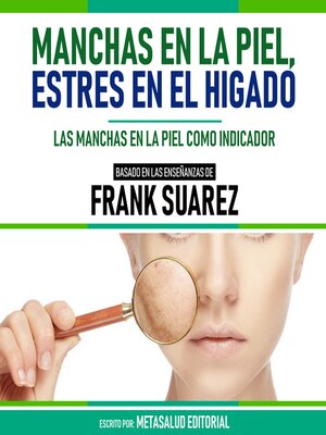 cover image of Manchas En La Piel, Estres En El Higado--Basado En Las Enseñanzas De Frank Suarez